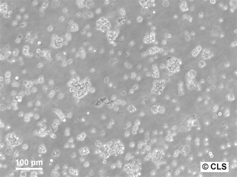 jerkat|Jurkat cells .